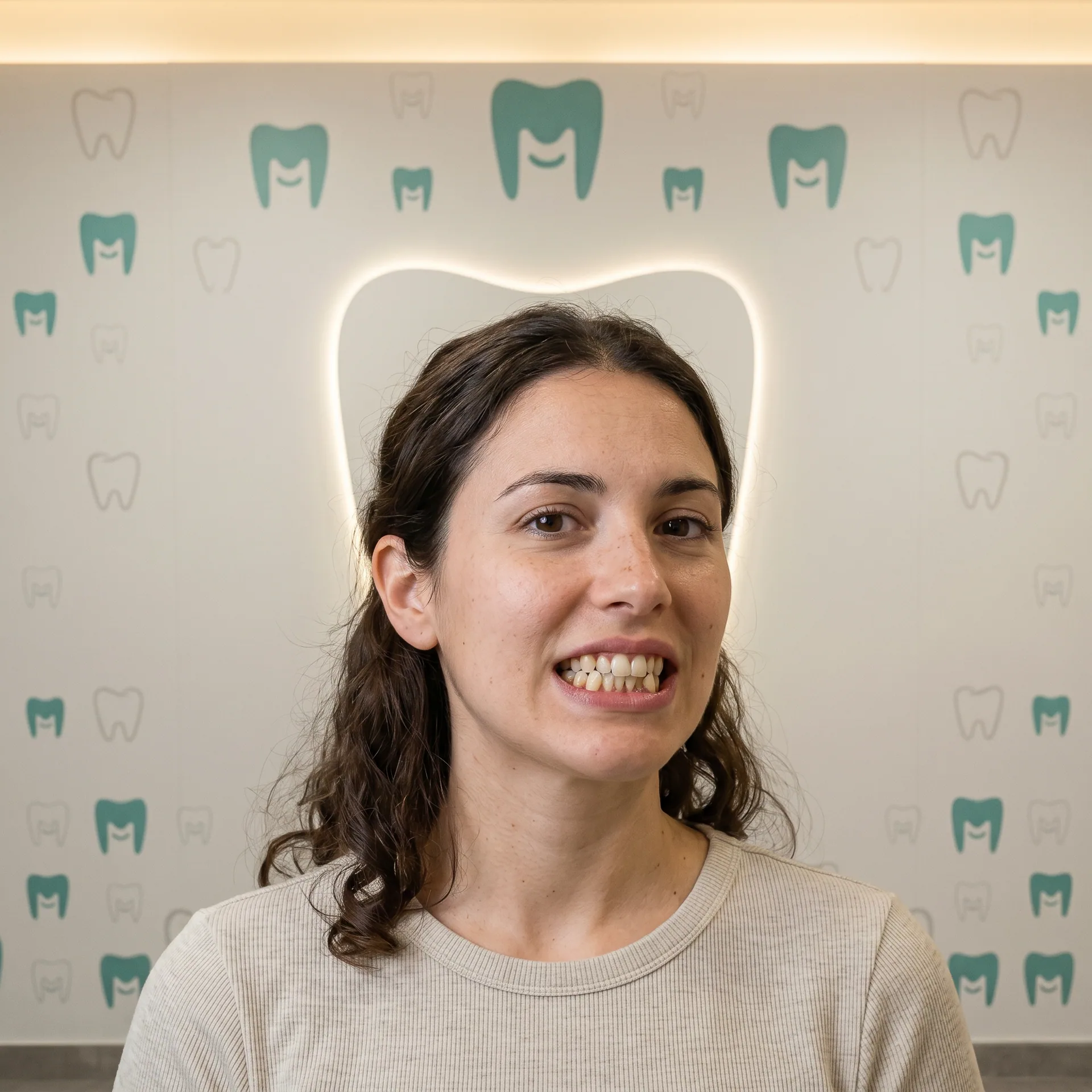 Caso de ortodoncia invisible MAKEDA smile. antes — apiñamiento severo